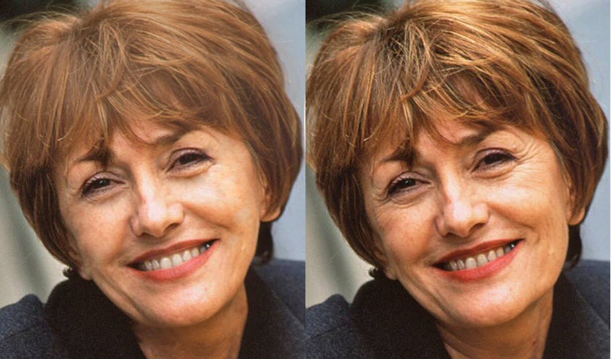 عکس صورت قبل و بعد از کانتورینگ